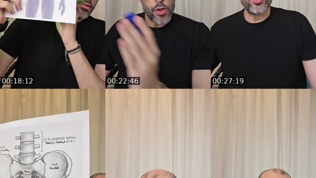 القولون السيني، Sigmoid Colon - @nel7awy7