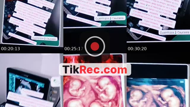 TikTok live: Recordando la primera Ecografía by @cuatrillizoscaucasia